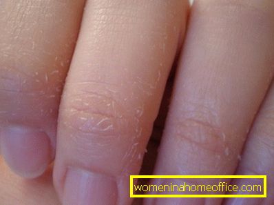 Лущення шкіри на пальцях